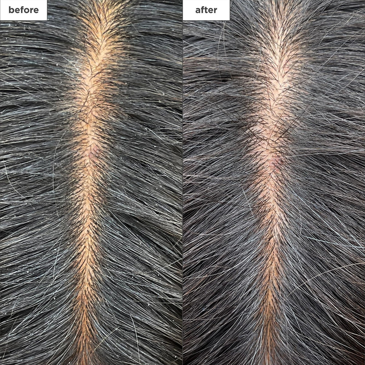 Cooling Scalp Mask with Charcoal & Tea Tree for Hydration & Relief – Vegan & Natural
