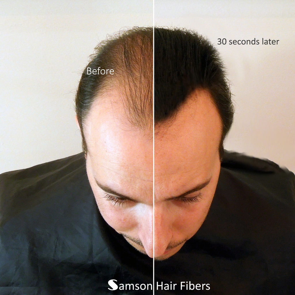 Hair Loss Concealer Fibers Brown 50g Refill for Natural Coverage