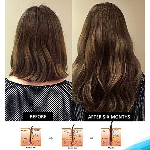 Clinical Strength Hair Growth Shampoo with Biotin Collagen DHT Blockers 8 oz
