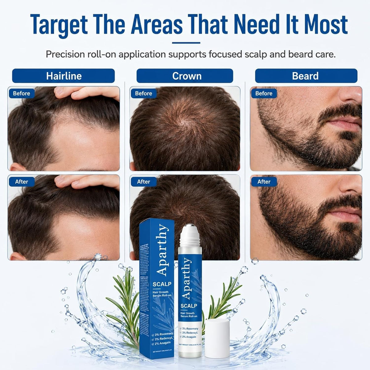 Rosemary Hair Growth Serum Roll-On - 0.85 Fl Oz, Pack of 2