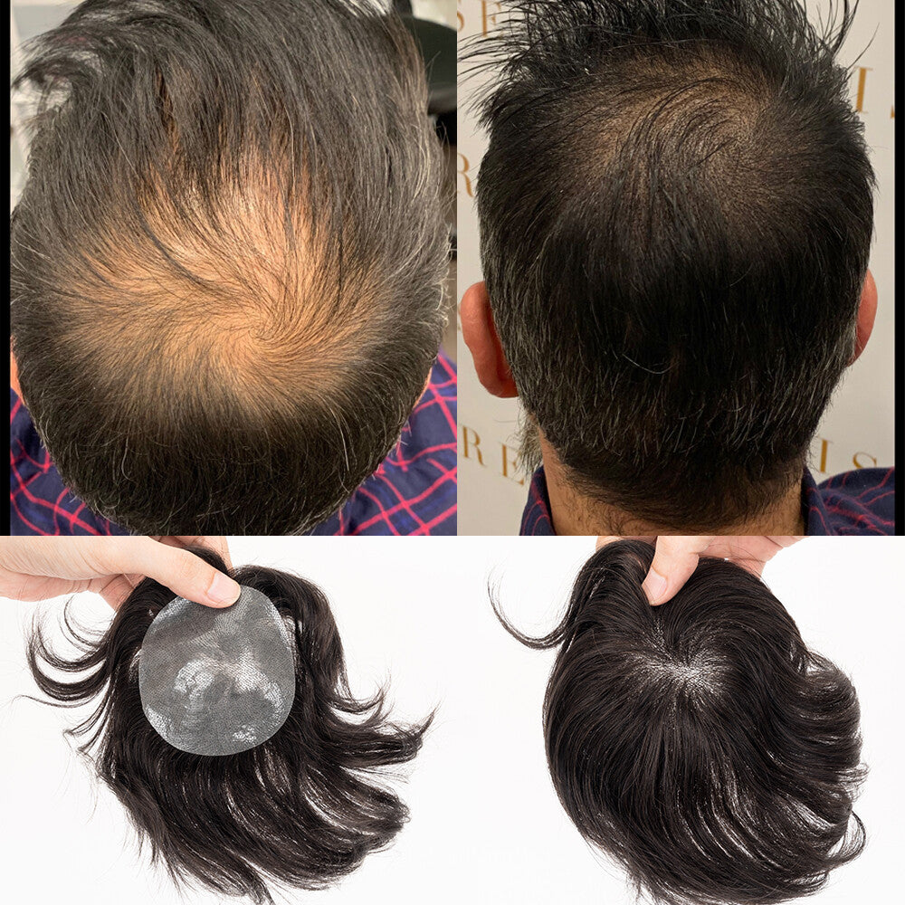 Men's Hair Patch Toupee for Bald Spot Full Skin Base Natural Remy Human Hair