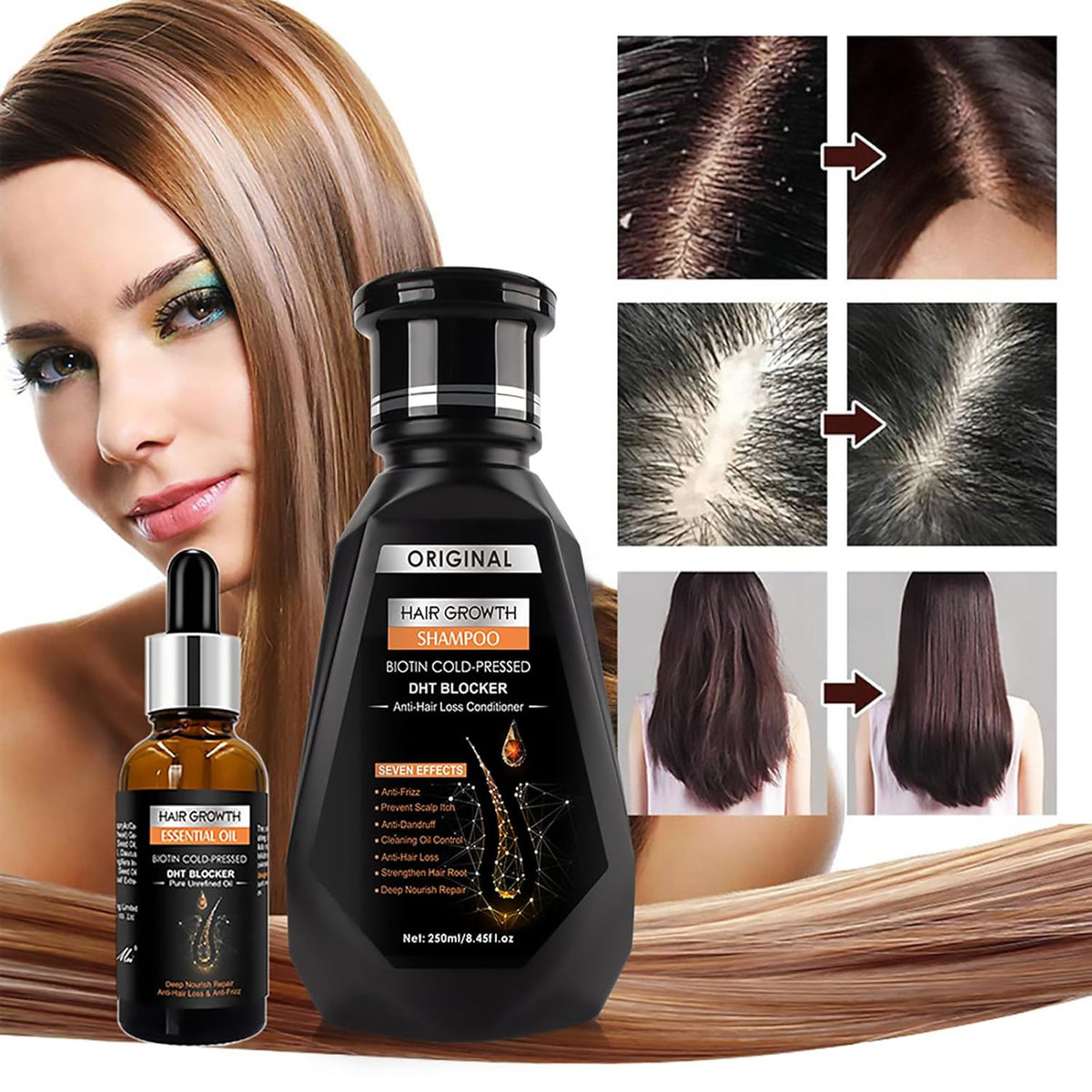 Hair Growth Essential Oil Set for Hair Loss & Scalp Nourishment - Natural Therapy