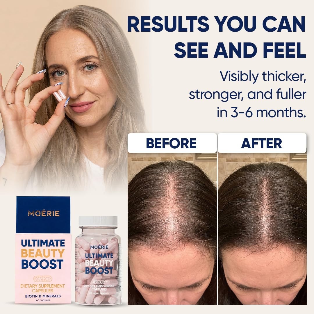 Hair Growth Supplements for Women & Men - Biotin, Vitamins & Minerals - 60 Capsules