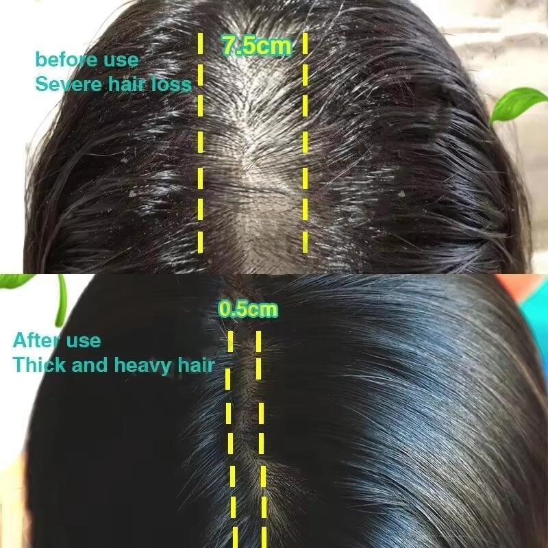 Hair Growth Oil for Hair Loss & Regrowth - Nourishing Rosemary Treatment 50ml