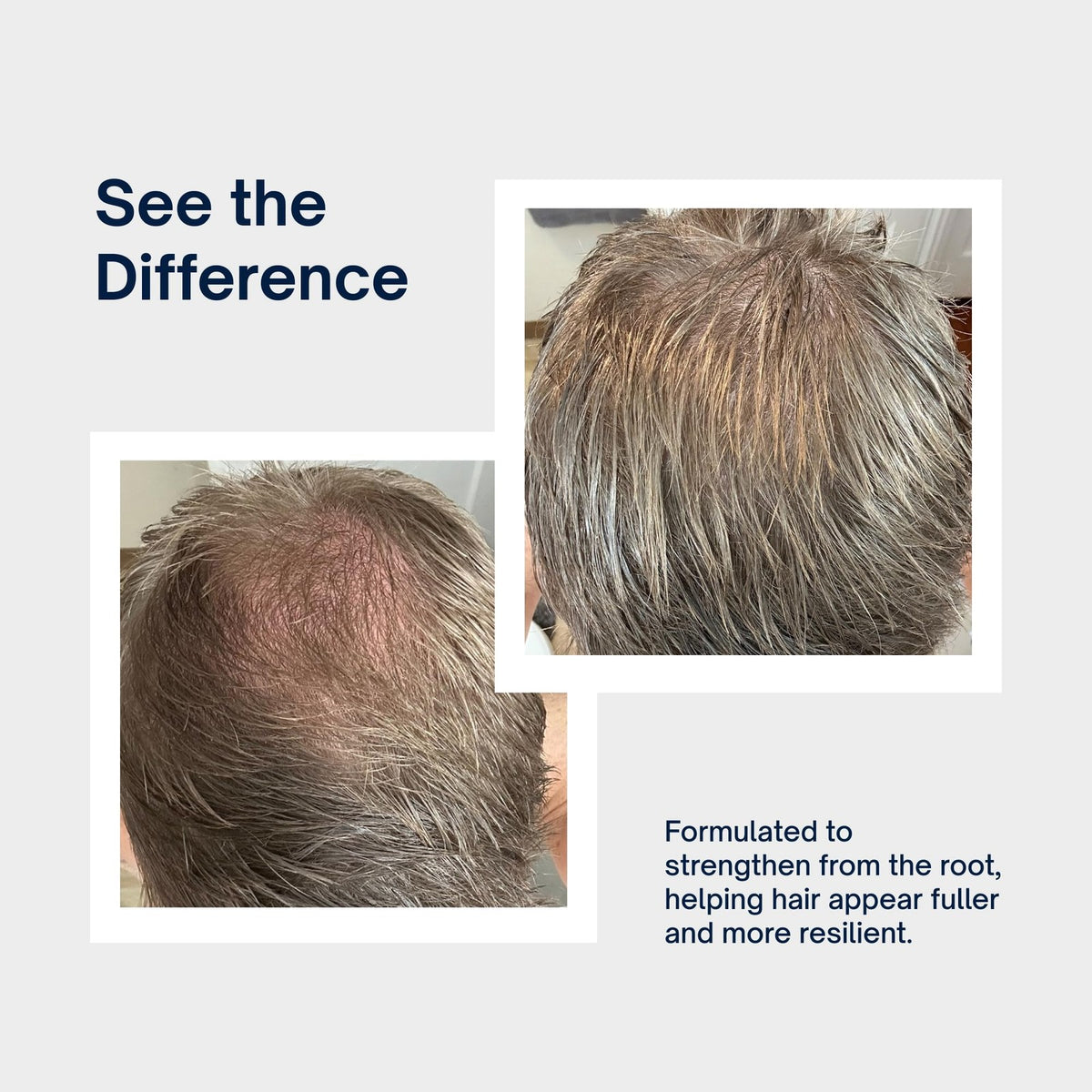 Volumizing Shampoo for Thinning Hair - Strength & Lift, 10 Fl Oz