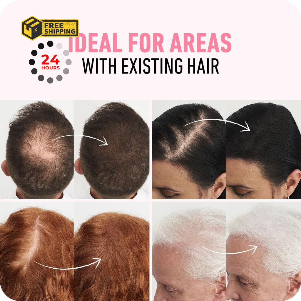 Hair Fibers for Thinning Hair - Fill In Volume & Conceal Bald Spots, 12g Ash Brown
