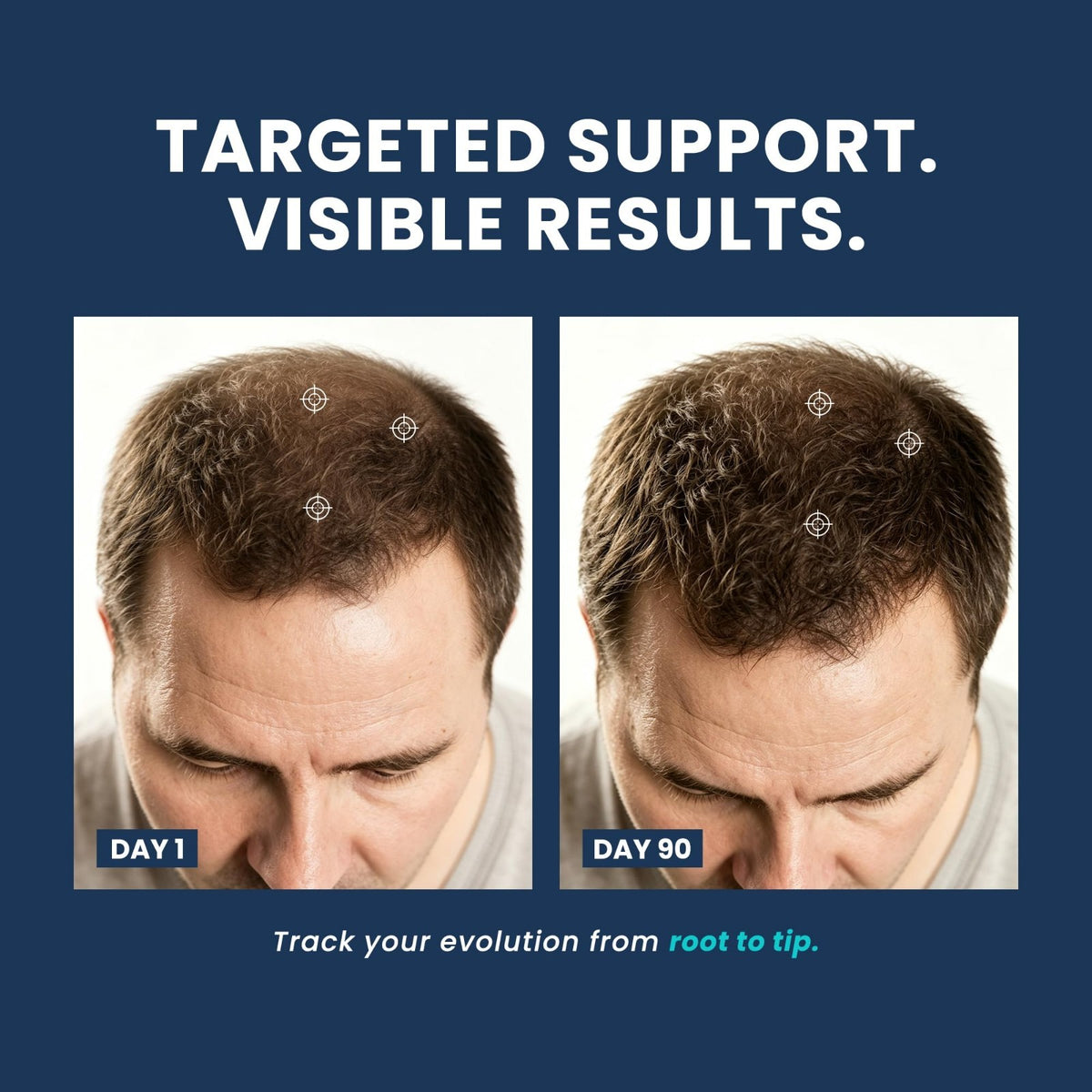 Hair Thickening System with Copper Peptide & Caffeine - 1 Month Treatment