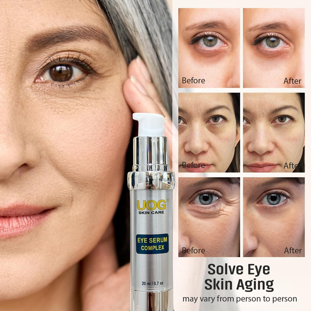 Eye Serum for Dark Circles Puffiness Wrinkles - 20ml Hydrating & Firming
