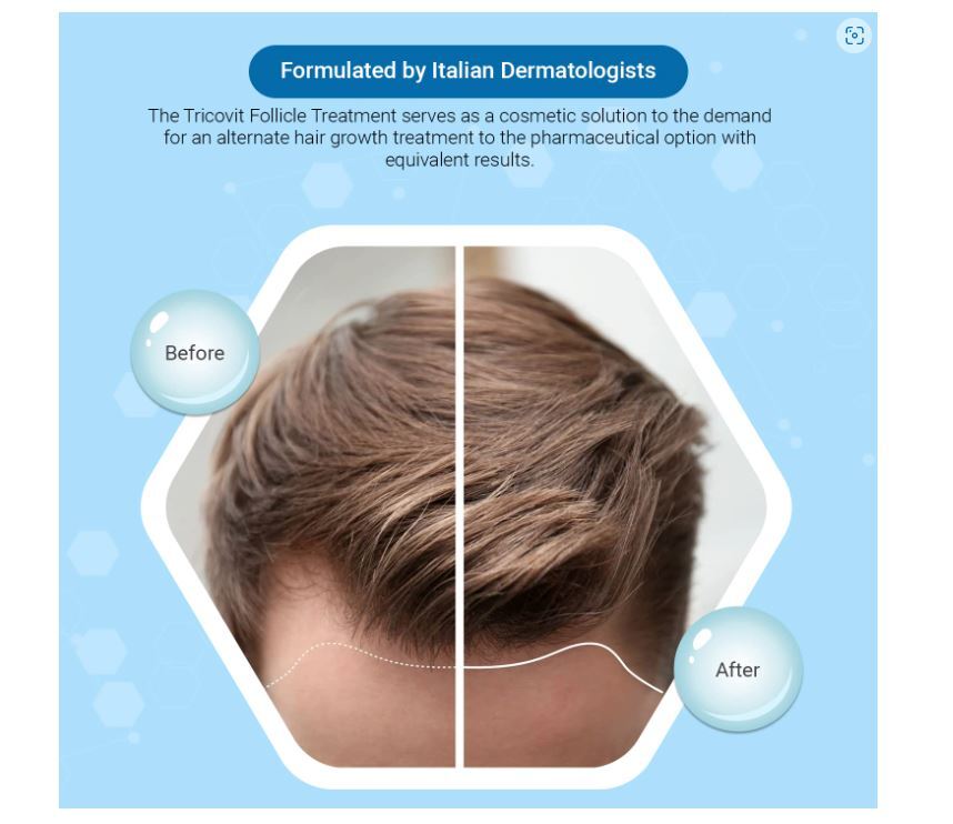 Hair Growth Stimulating Hair Lotion 10-Pack - Regulates Sebum & Scalp Health