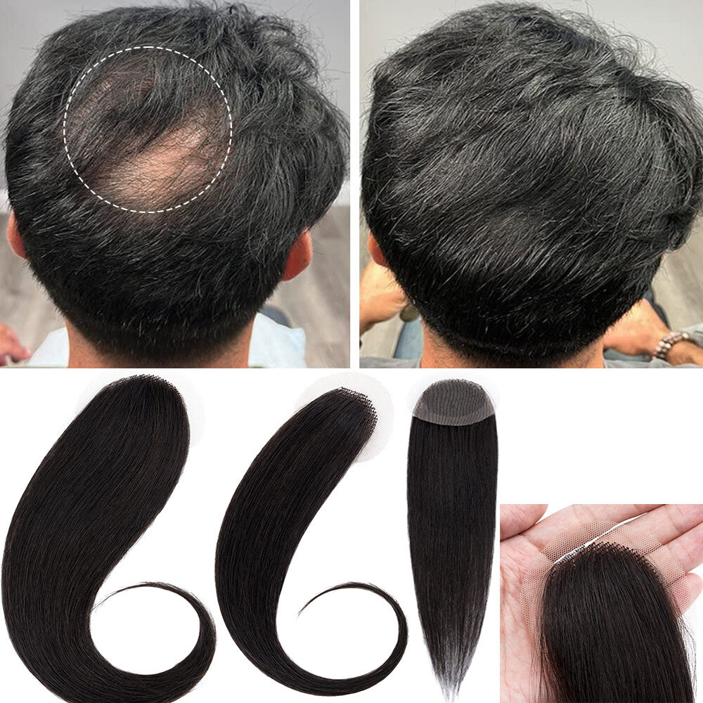 Full Lace Hair Cover-up Tape Patches for Hair Loss & Alopecia, Human Hair