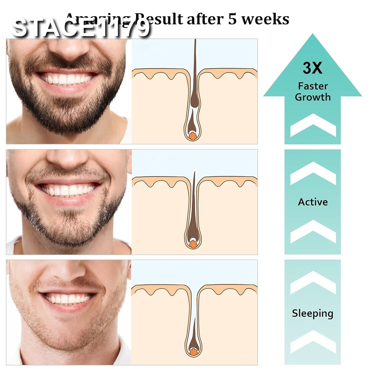 Premium Beard Growth Kit with Biotin Oil and Professional Massager