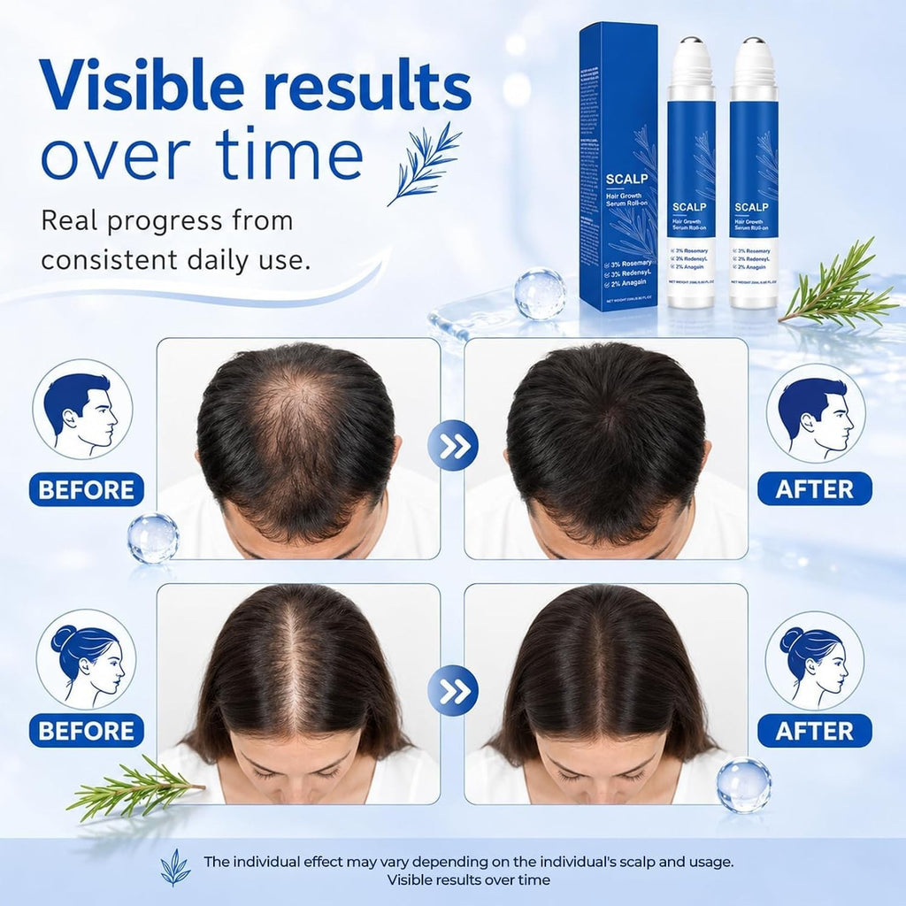 Hair Growth Serum Roll-On for Thicker Hair & Scalp - 2 Pack 0.85 Fl Oz