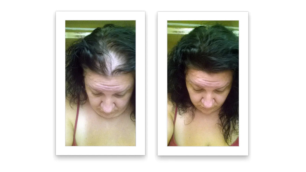 Hair Fibers 30g Bottle - Natural Plant-Based Hair Loss Concealer