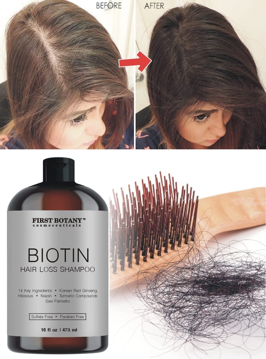 Natural DHT Blocker Shampoo for Hair Loss - Herbal Hair Growth Treatment, 16 oz