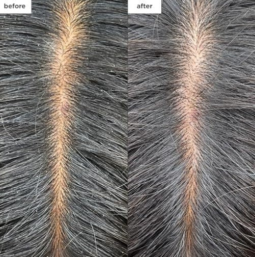 Cooling Scalp Mask with Charcoal & Tea Tree for Hydration & Relief – Vegan & Natural