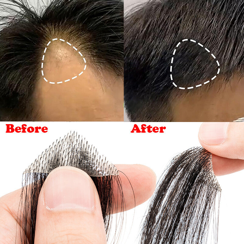 100% Remy Human Hair Mini Hairpieces for Men Temple Hairline Replacement