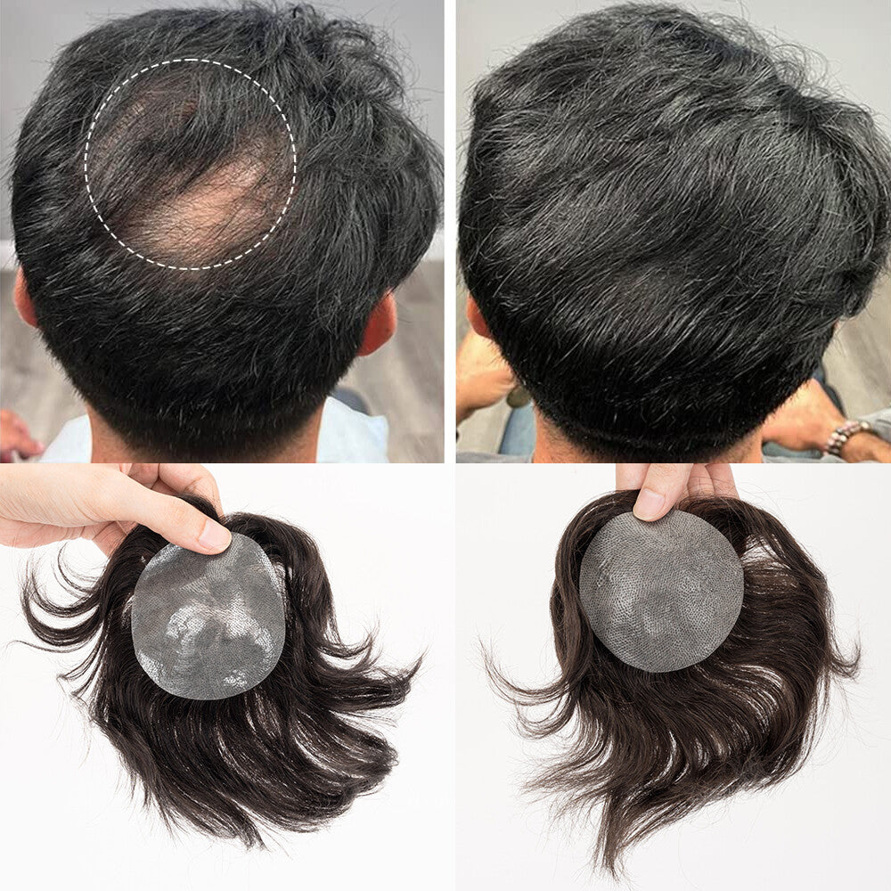 Men's Hair Patch Toupee for Bald Spot Full Skin Base Natural Remy Human Hair