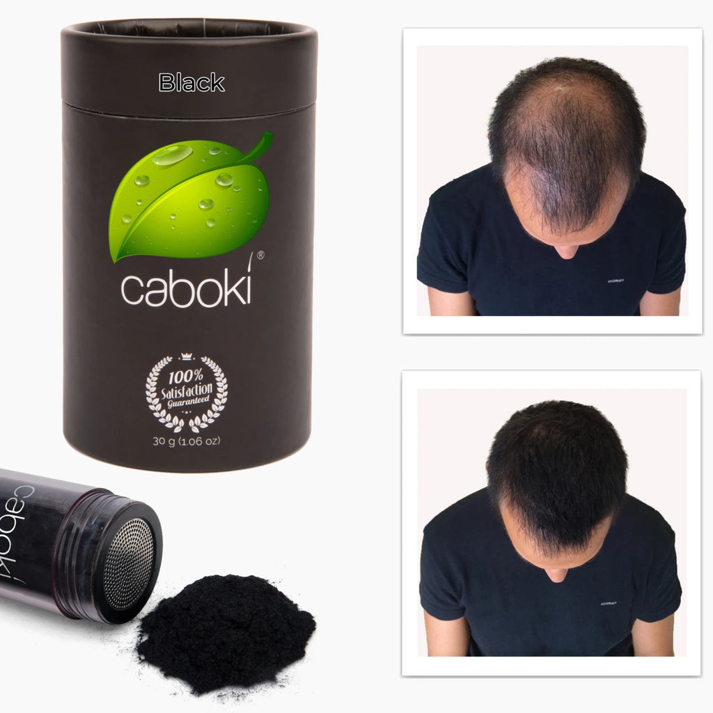 Hair Fibers 30g Bottle - Natural Plant-Based Hair Loss Concealer