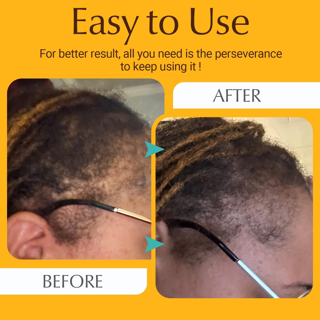 Hair Growth Comb for Men and Women - Portable & Easy to Use
