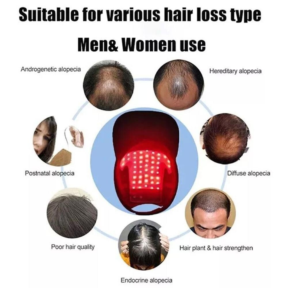 Red LED Light Therapy Hat for Hair Loss & Regrowth - 650nm 630nm 470nm
