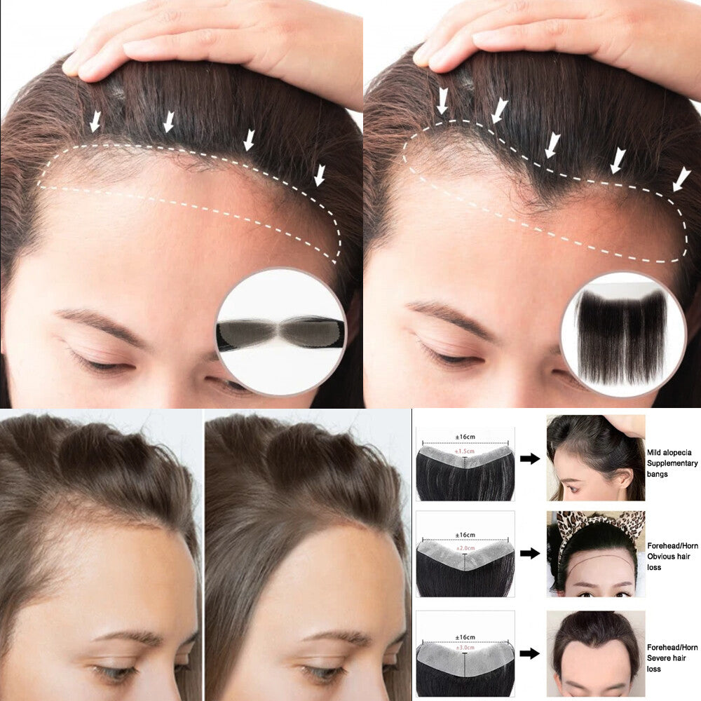 Human Hair Topper with Lace Base - Full Lace Hairpiece for Women