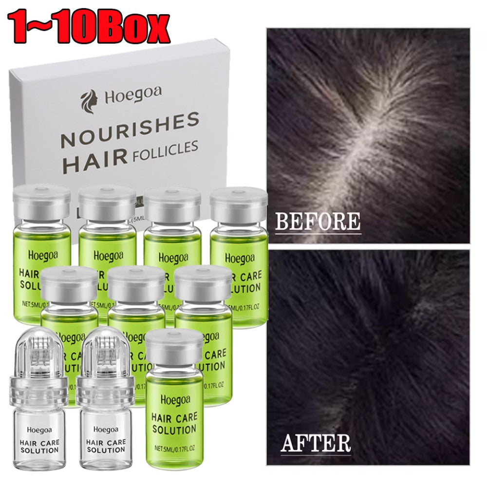 Micro Infuse Hair Regrowth System with Ginseng & Natural Extracts - Hair Loss Treatment & Thickening Serum - All Variants