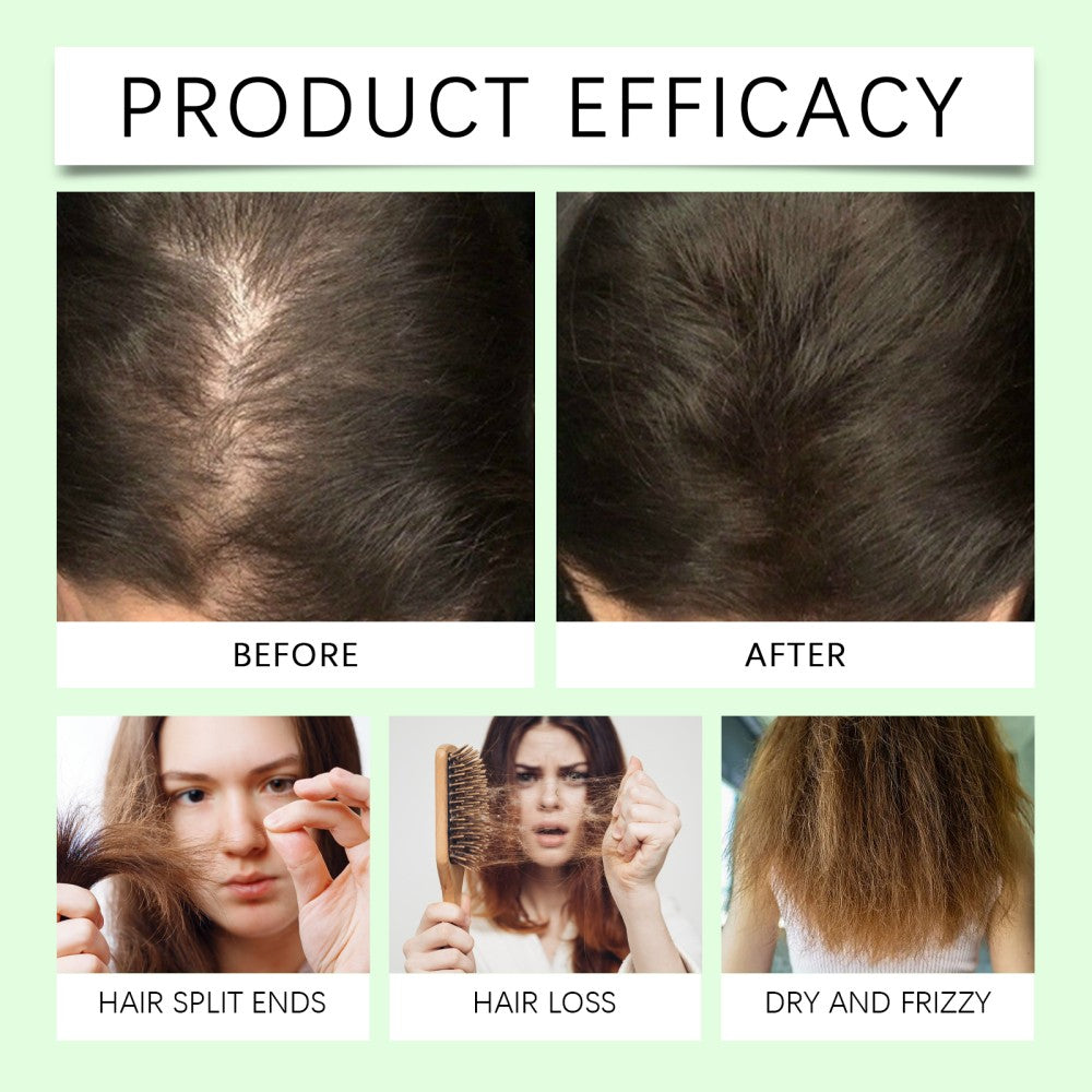 Organic Rosemary Hair Growth Shampoo for Thicker, Stronger Hair - 2 Pack