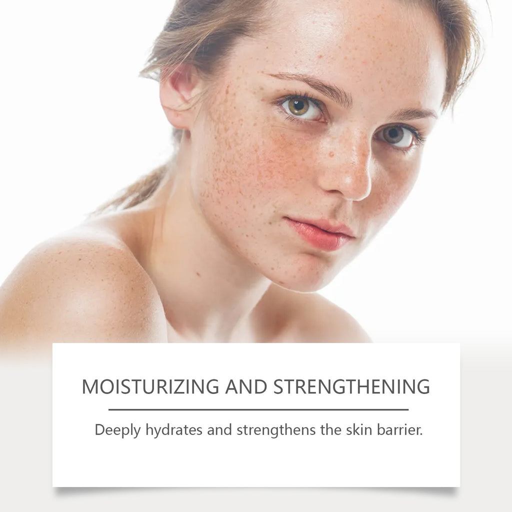 Anti-Hyperpigmentation Cream with Retinol for Sensitive Skin - 30g