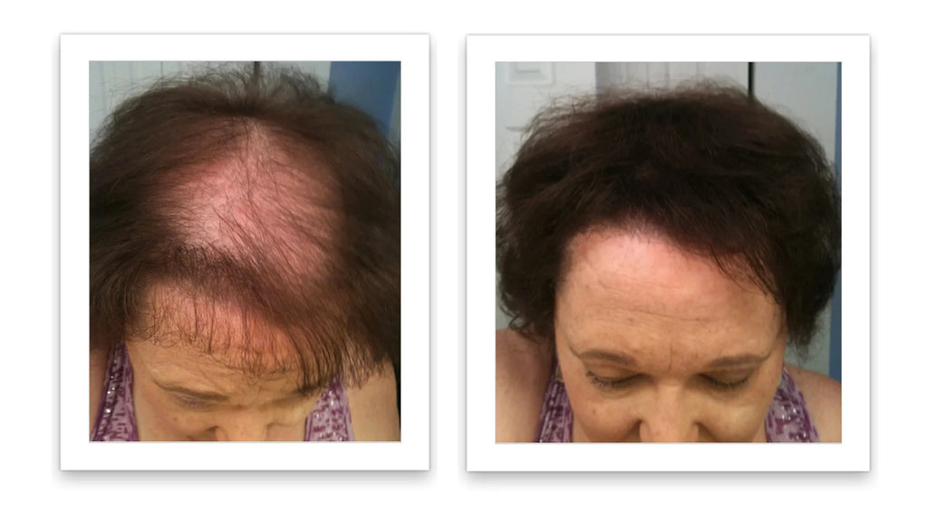 Hair Fibers 30g Bottle - Natural Plant-Based Hair Loss Concealer