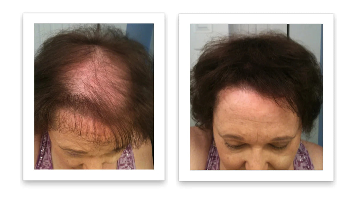 Hair Fibers 30g Bottle - Natural Plant-Based Hair Loss Concealer
