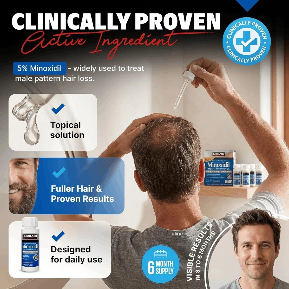 Minoxidil 5% Hair Regrowth Treatment for Men 6 Month Supply