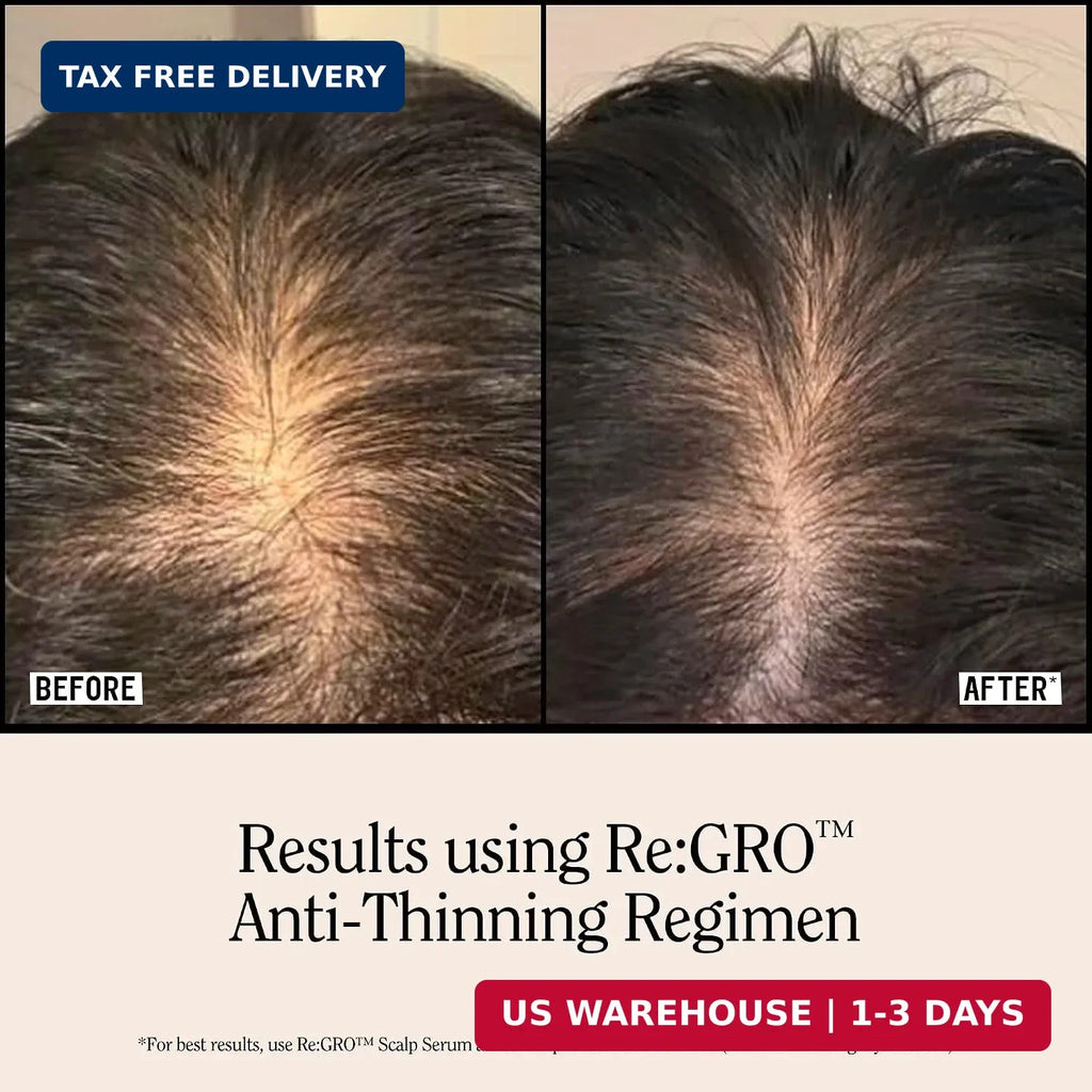 Men's Hair Growth Serum with Capixyl & Biotin - Thicker, Fuller Hair Support