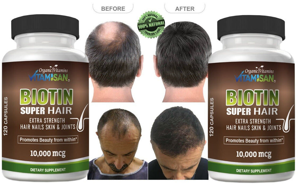 Hair Growth Vitamins - Biotin Support for Hair Loss - 240 Capsules