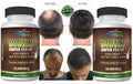 Hair Growth Vitamins - Biotin Support for Hair Loss - 240 Capsules