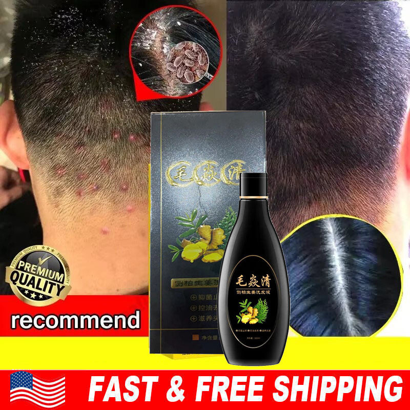 Natural Scalp & Hair Follicle Shampoo for Dandruff Itching Oil Control 200ml