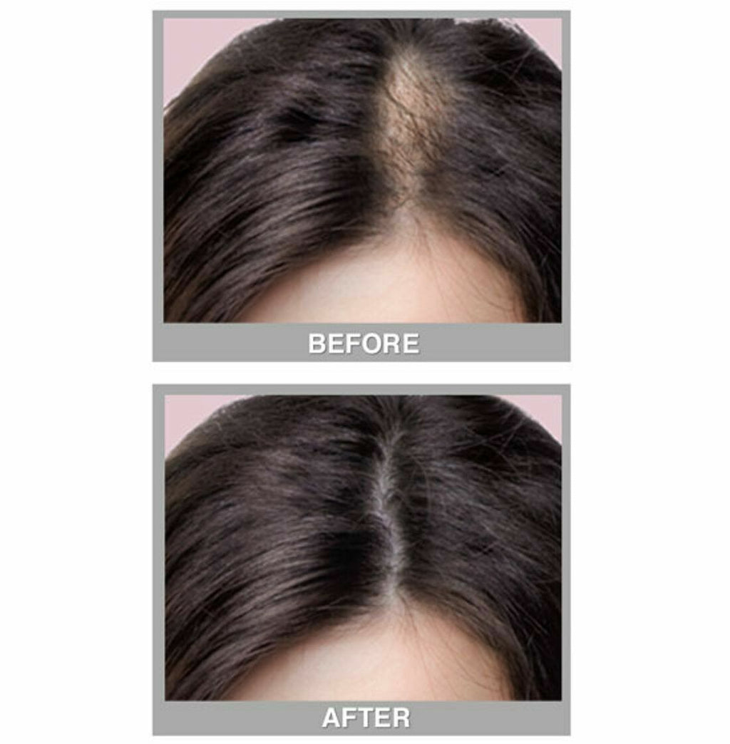 3-Pack Hair Concealer Powder for Thinning & Bald Spots - 8 Shades