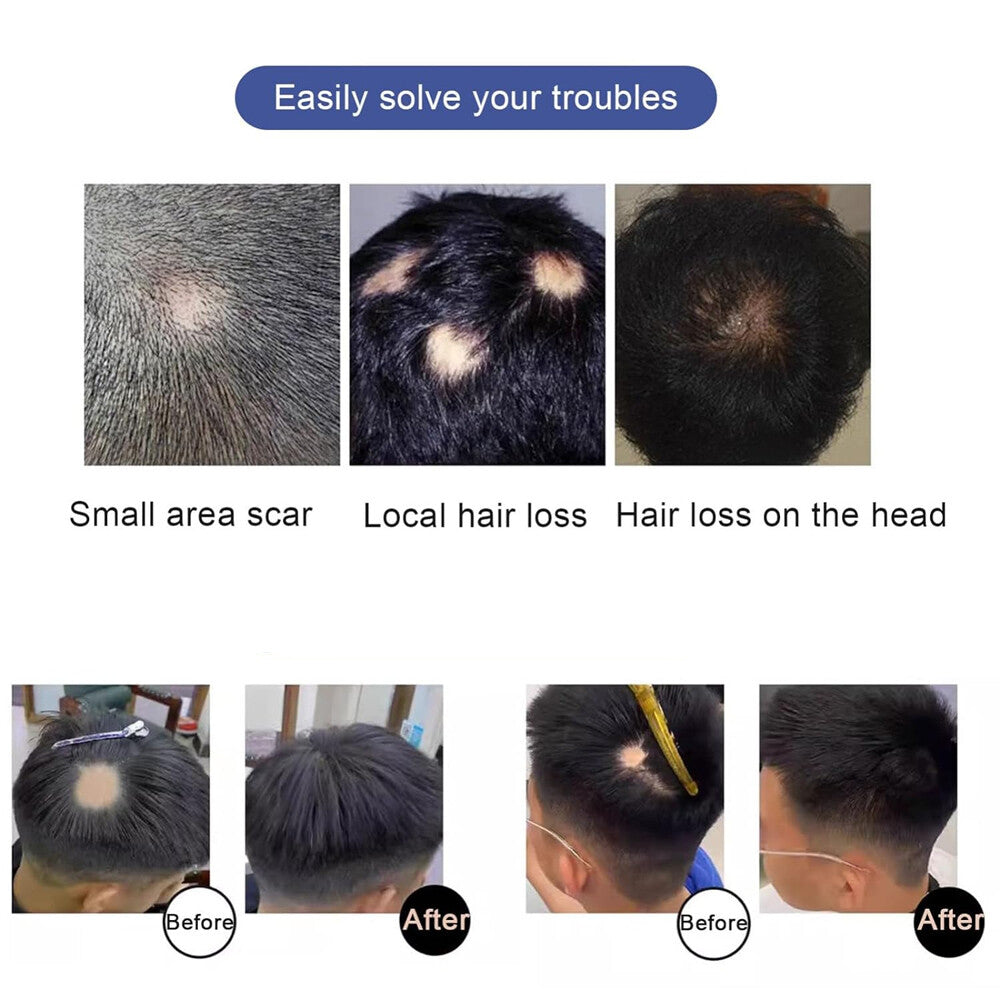 Full Lace Hair Cover-up Tape Patches for Hair Loss & Alopecia, Human Hair