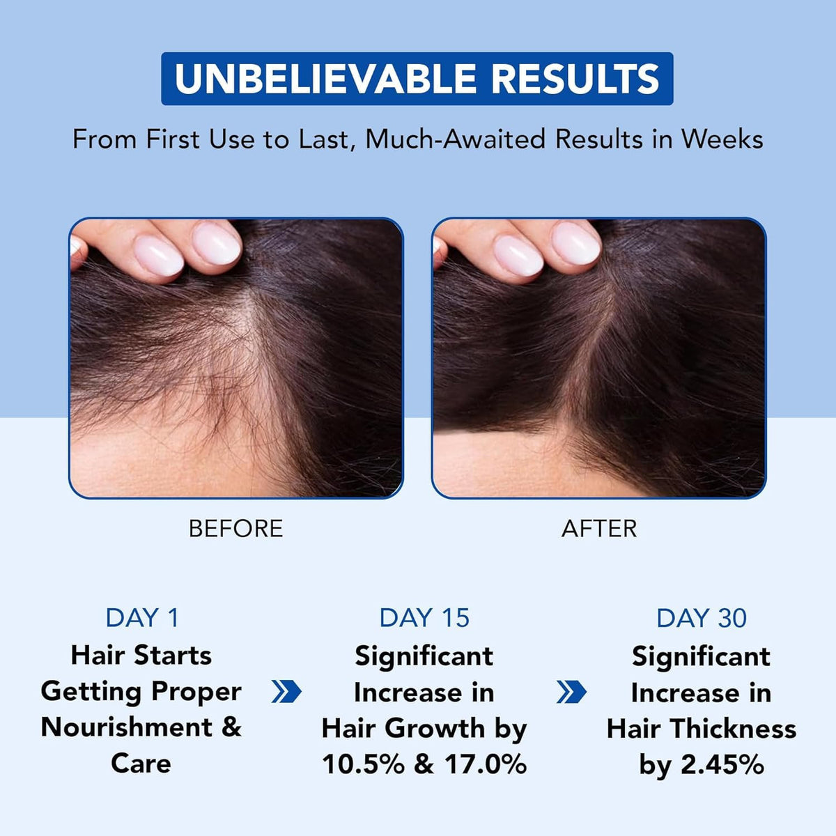 Rosemary Hair Oil for Hair Growth & Thickening - 6.7 Fl Oz