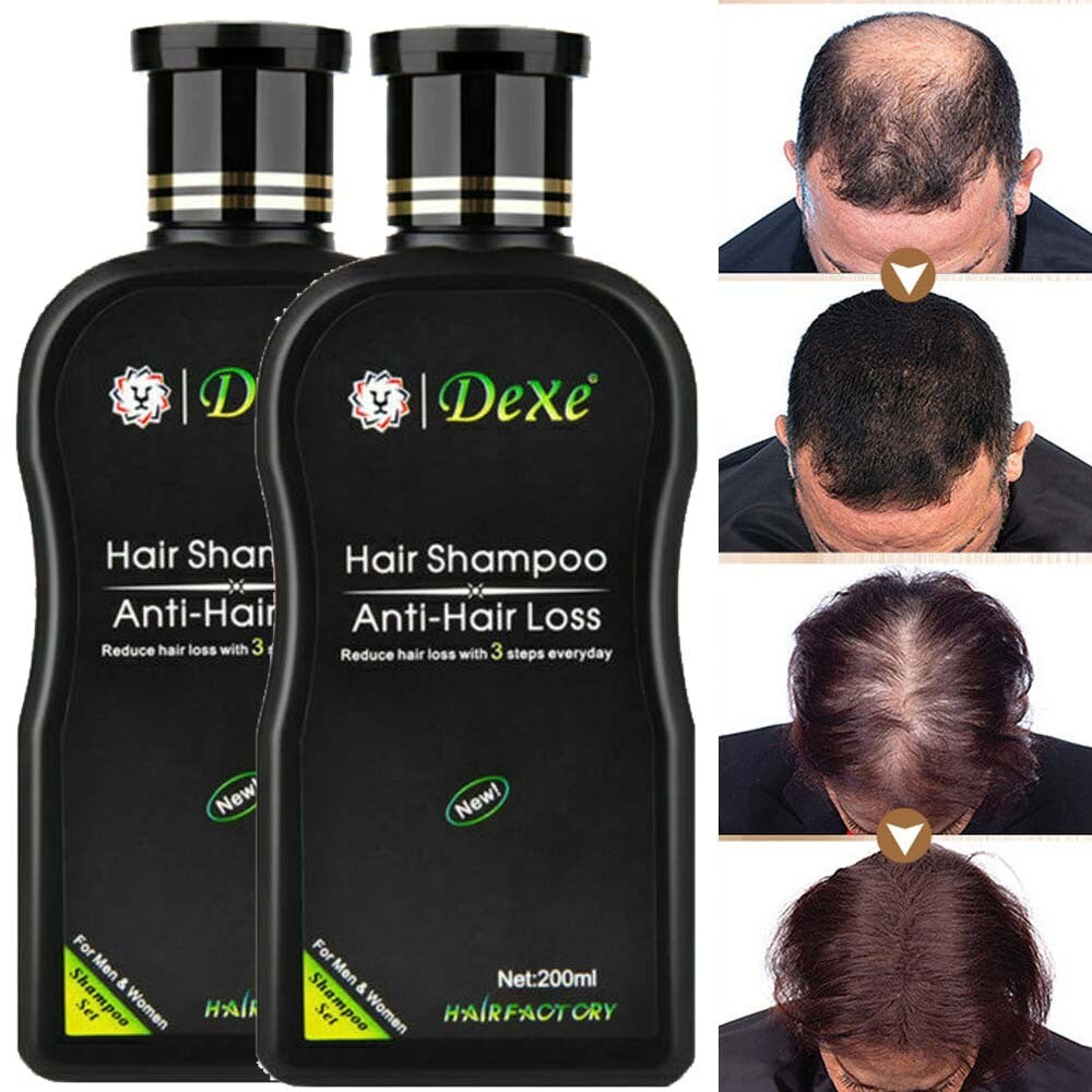 Anti-Hair Loss Shampoo for Men & Women - Herbal Hair Regrowth 200ml