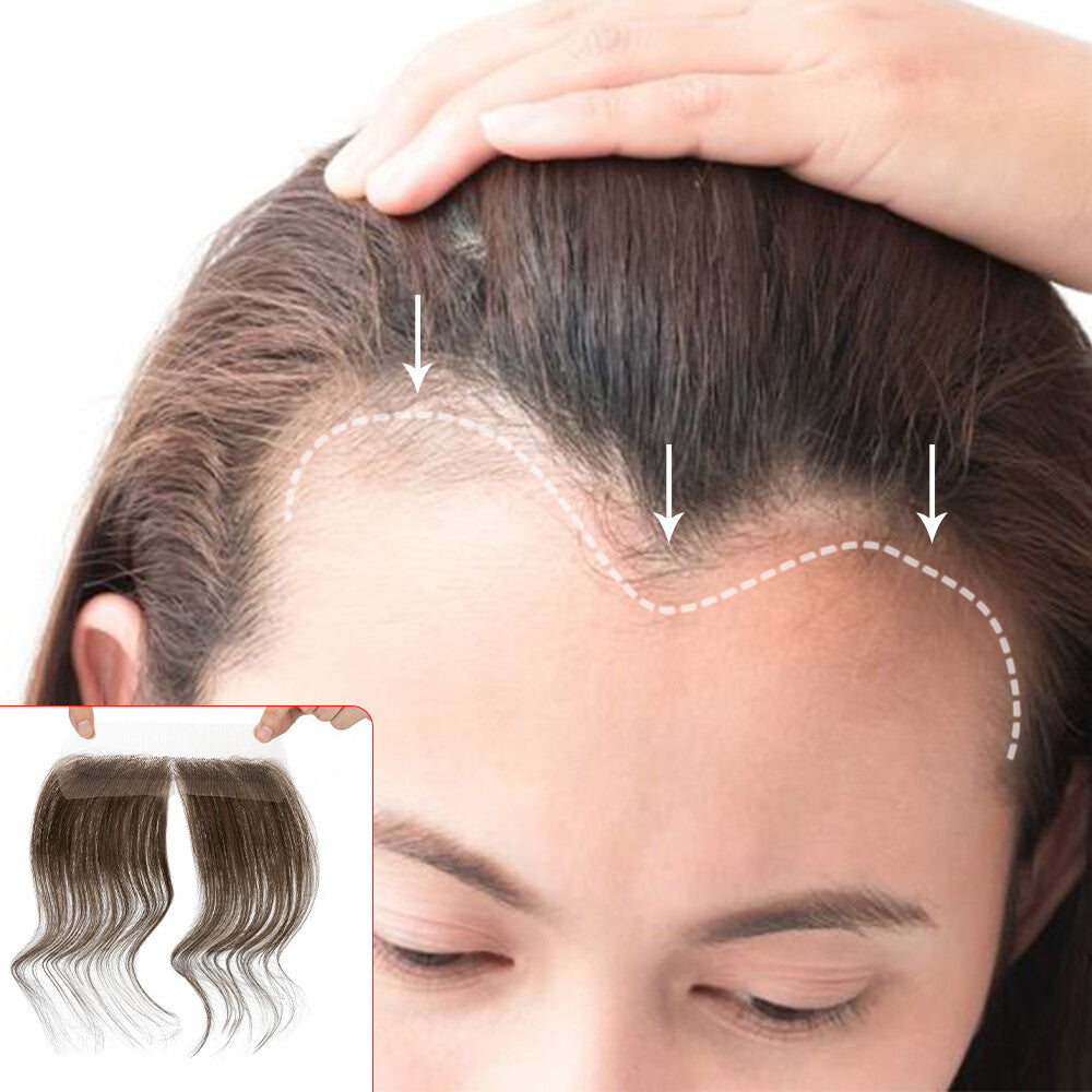 Full Lace Hair Topper for Women Receding Hairline Cover Remy Human Hair