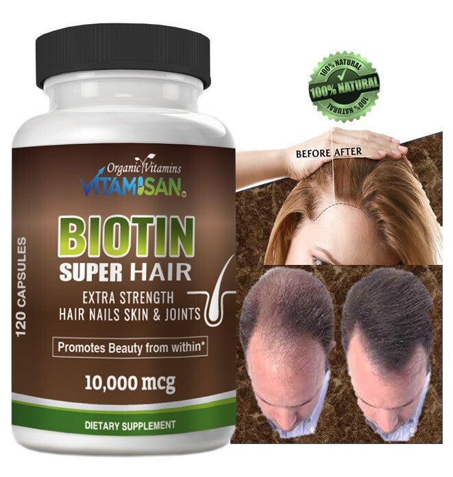 Hair Growth Vitamins - Biotin Support for Hair Loss - 240 Capsules