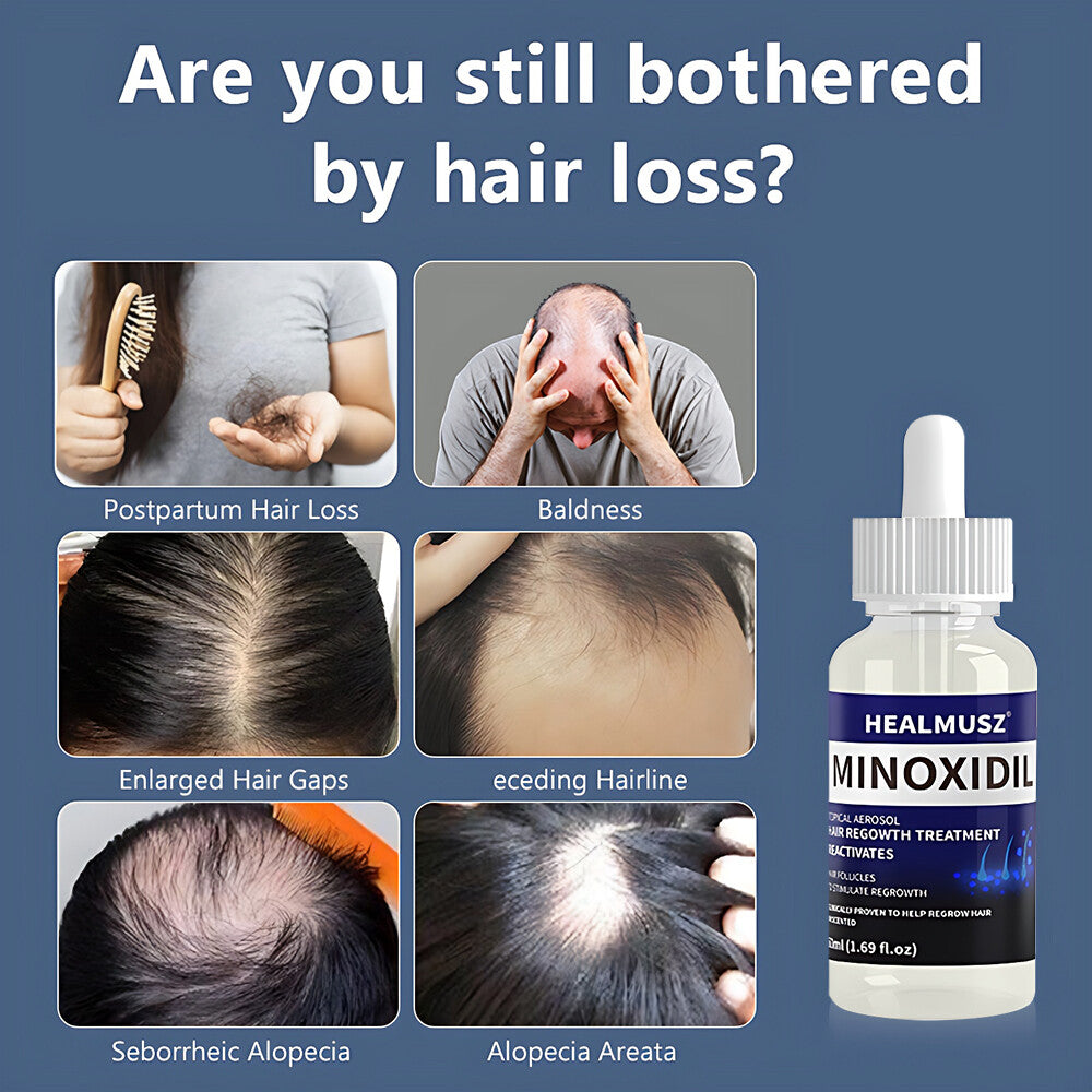 Men's Hair Regrowth Treatment with Minoxidil 5% - 4 Pack, 4 Month Supply