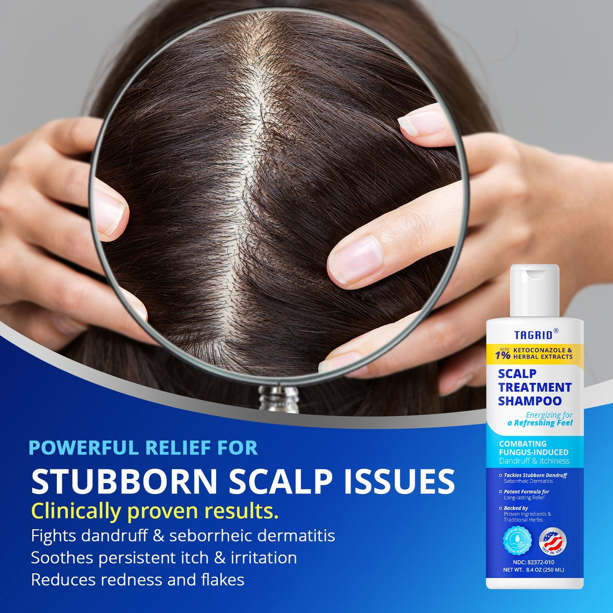 Herbal Antifungal Shampoo for Dandruff Oily Scalp - Ketoconazole & Herbal Extracts