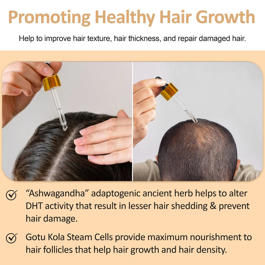 Hair Growth Serum for Thinning Hair & Hair Loss Reduction - 2N Ultra Restore