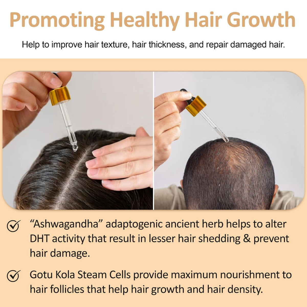 Hair Growth Serum for Thinning Hair & Hair Loss Reduction - 2N Ultra Restore