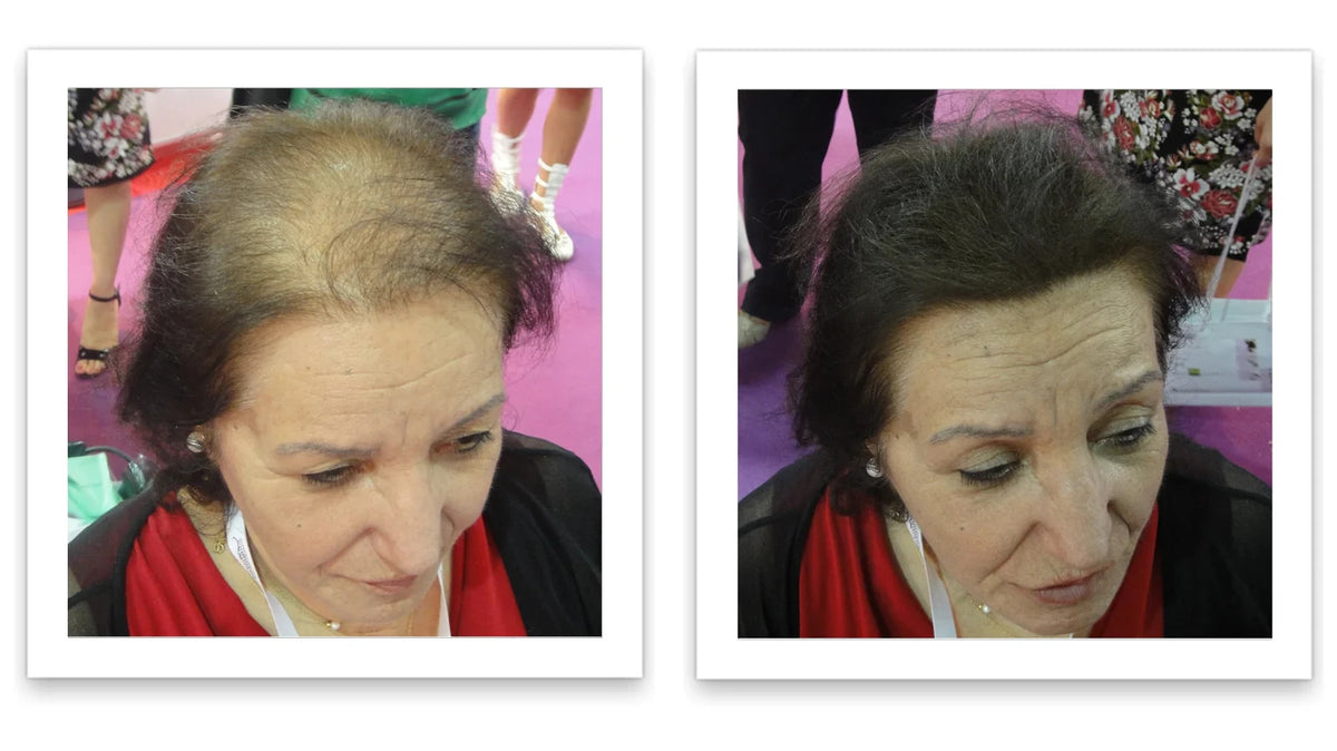 Hair Fibers 30g Bottle - Natural Plant-Based Hair Loss Concealer