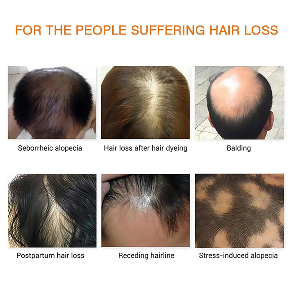 Hair Growth Essential Oil Set for Hair Loss & Scalp Nourishment - Natural Therapy