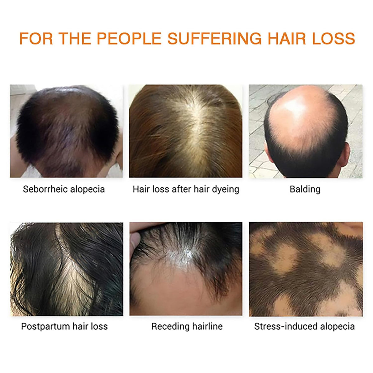 Hair Growth Essential Oil Set for Hair Loss & Scalp Nourishment - Natural Therapy