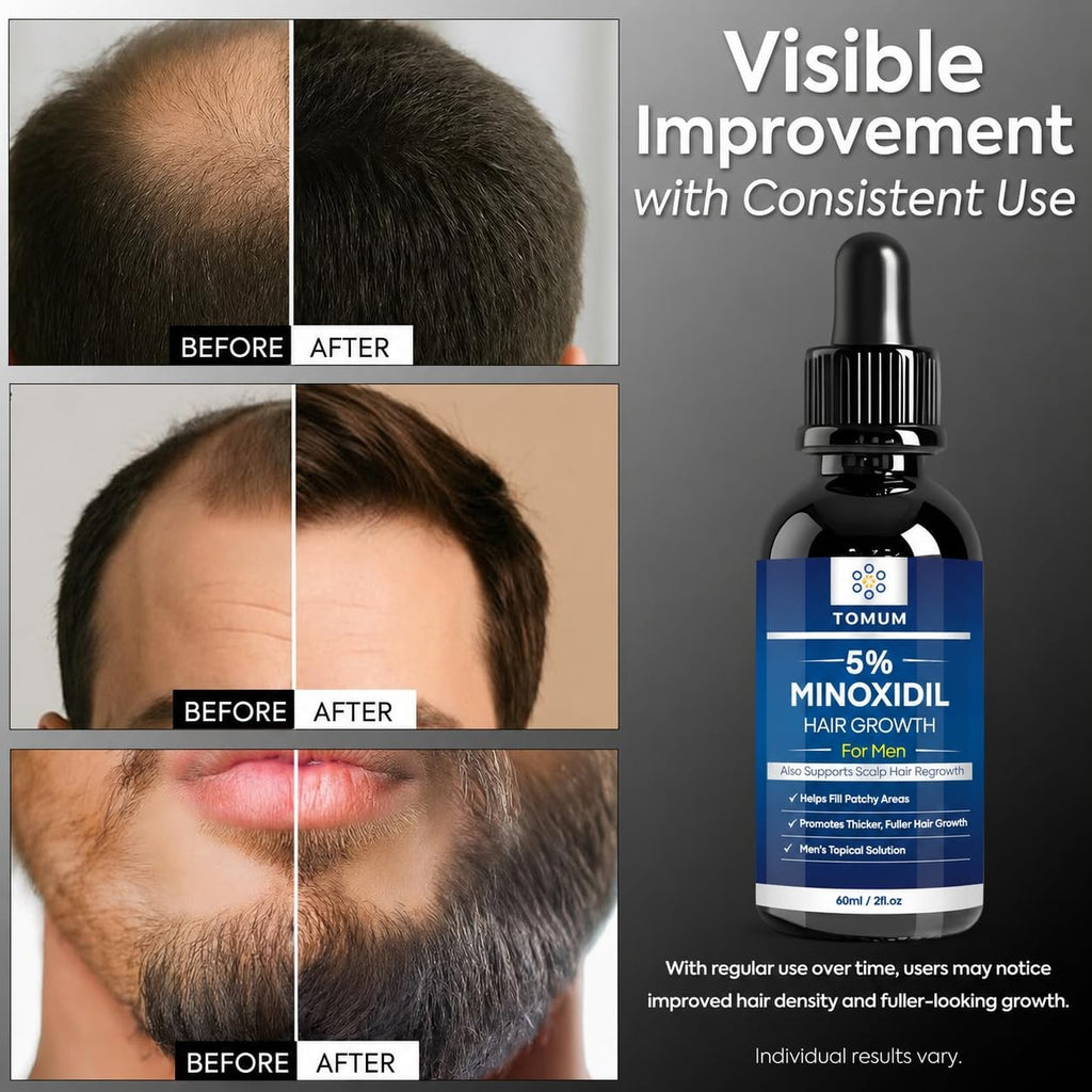 Men's Beard Growth Kit with 5% Minoxidil - Faster Thicker Facial Hair