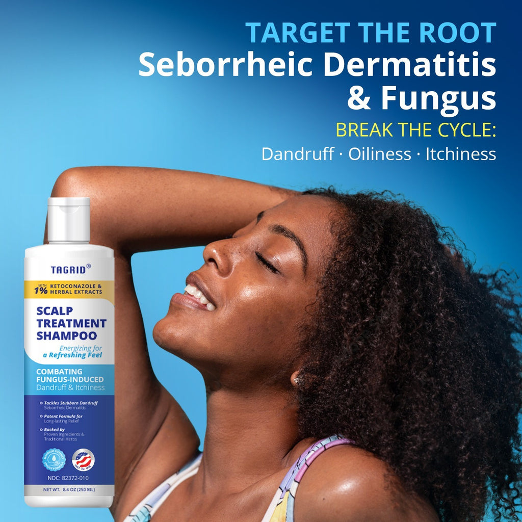 Herbal Antifungal Shampoo for Dandruff Oily Scalp - Ketoconazole & Herbal Extracts